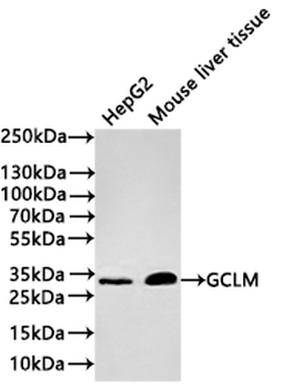 GCLM Antibody