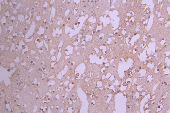 GCLM Antibody