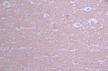 CRMP1 Antibody
