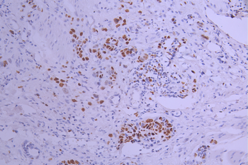MCM7 Antibody