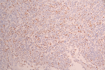 MCM7 Antibody
