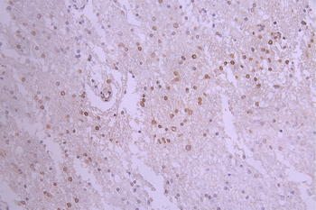 LMNB2 Antibody