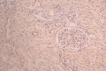 LMNB2 Antibody