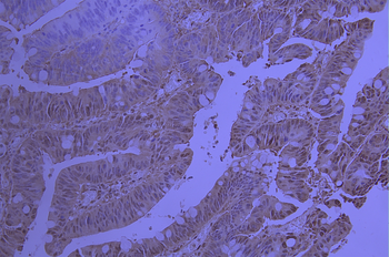 RBX1 Antibody