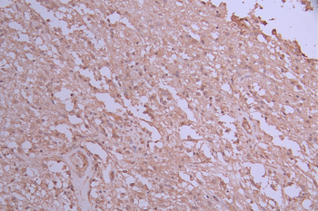 CRADD Antibody