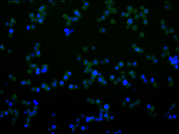 CRADD Antibody