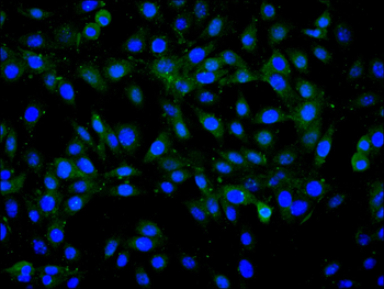 CAMK4 Antibody