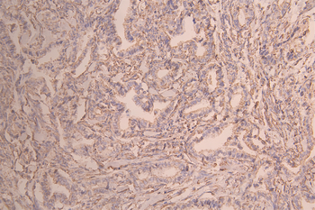 KLC3 Antibody