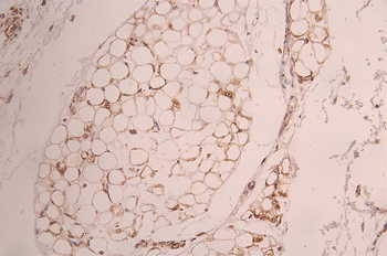 KLC3 Antibody