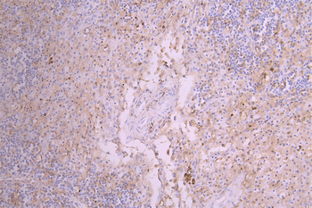 HMOX1 Antibody