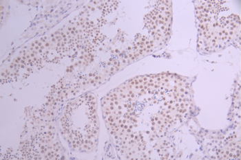 CCNH Antibody