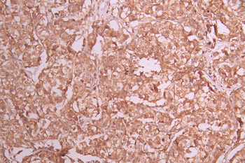 MAP2K2 Antibody