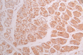 MAP2K2 Antibody