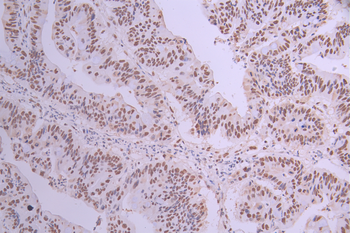 SET Antibody