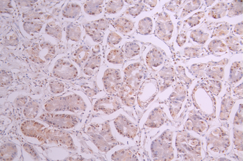 SET Antibody