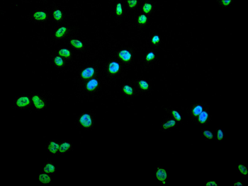 SET Antibody