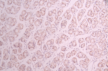 FOXP1 Antibody