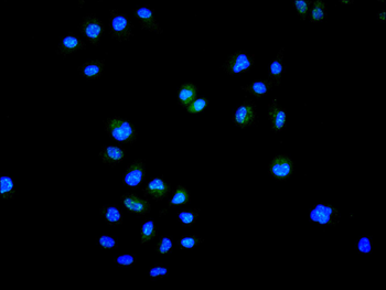 FOXP1 Antibody