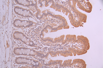 GORASP1 Antibody