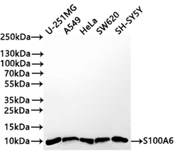 S100A6 Antibody