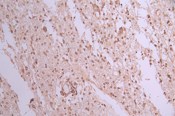 RANGAP1 Antibody