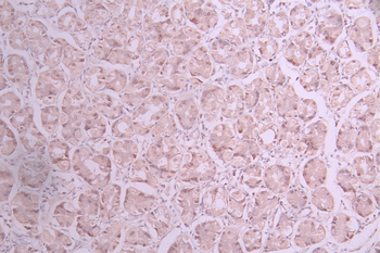 RANGAP1 Antibody