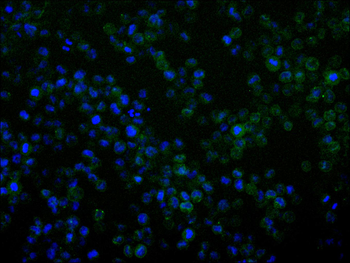 RANGAP1 Antibody