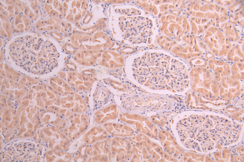 LPIN1 Antibody
