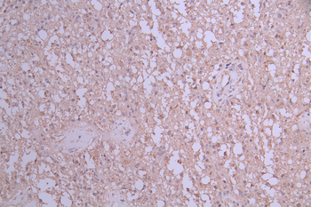 GOPC Antibody
