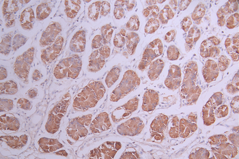 GOPC Antibody