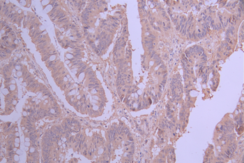 PUM1 Antibody