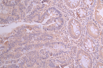 TPM1 Antibody