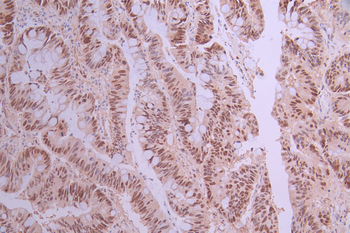 CHAF1B Antibody