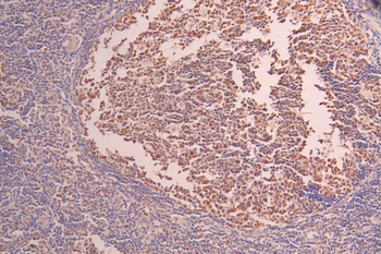 CHAF1B Antibody