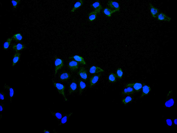 CHAF1B Antibody
