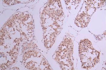 BUB3 Antibody