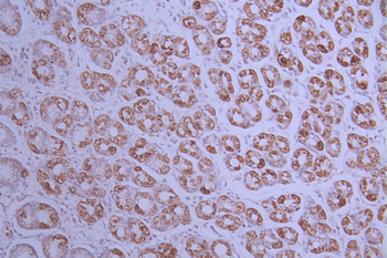 MT-CO2 Antibody