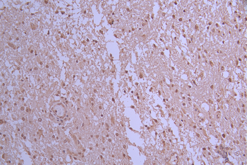 PPP1CB Antibody