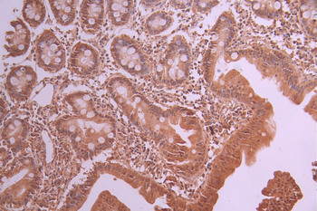PPP1CB Antibody