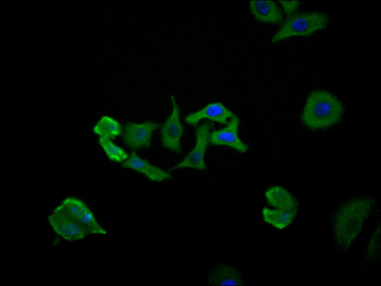 PPP1CB Antibody
