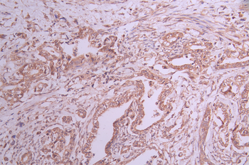 EHD1 Antibody