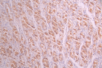 TAB1 Antibody