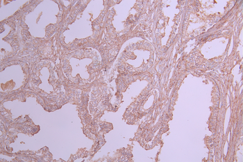 GNB2 Antibody