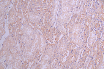 GNB2 Antibody