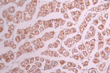 GSTK1 Antibody