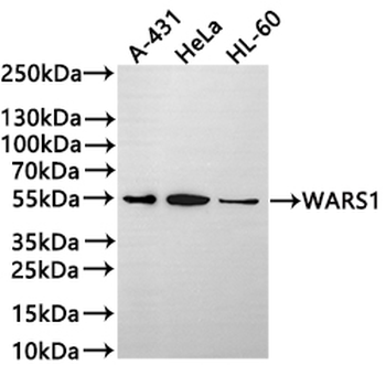 WARS1 Antibody