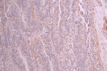 DFFA Antibody