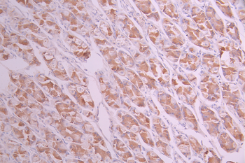 DFFA Antibody