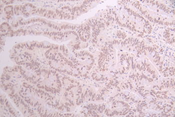 RCC1 Antibody
