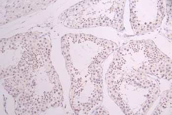 RCC1 Antibody
